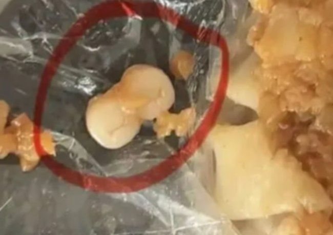 Необычные находки: искусственные зубы в продуктах питания Китая