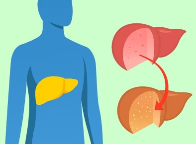 Проблемы с ожирением печени: пути решения