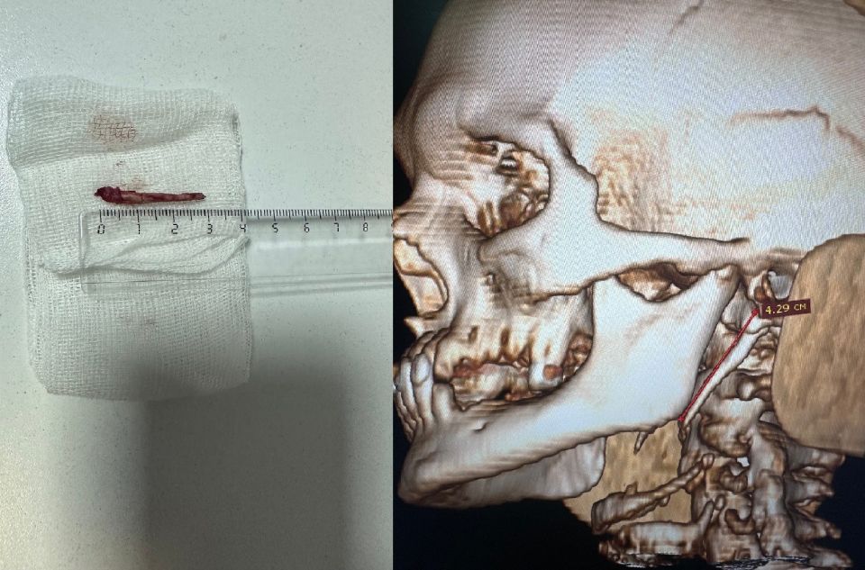 ���������� �������� ������� � ���������� �����������